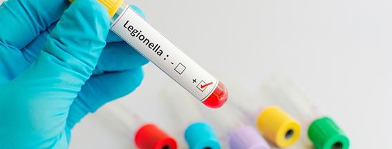 ¿Como prevenir la Legionella?