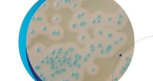detección de Bacillus cereus en alimentos