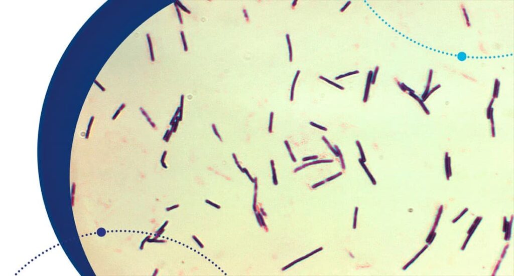 Actualización legislativa en la Norma ISO 15213 para la Detección y Enumeración de Clostridium